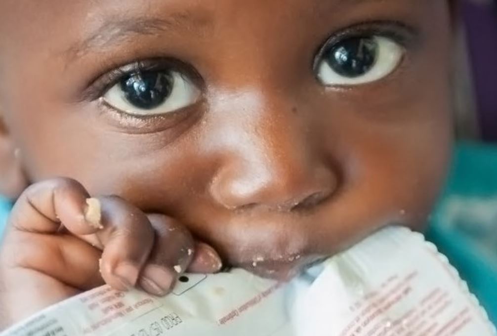 Child with Plumpy’Nut